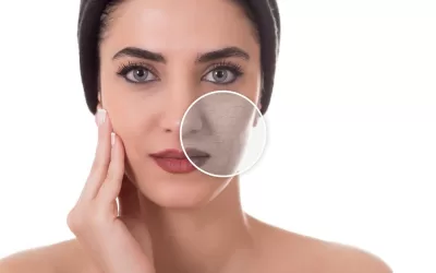 Prendersi cura della pelle del viso secca: segui i nostri consigli