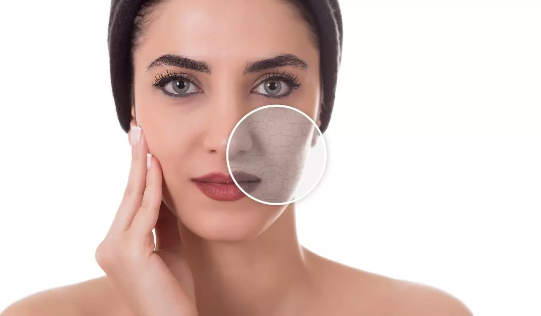 Prendersi cura della pelle del viso secca: segui i nostri consigli