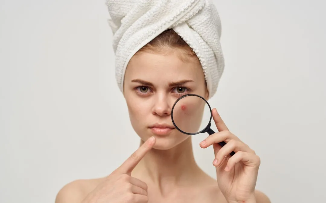 Come curare il rossore sul viso? Segui i nostri consigli
